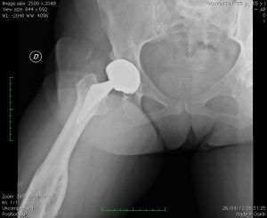 Corticali spesse piccola taglia a destra
